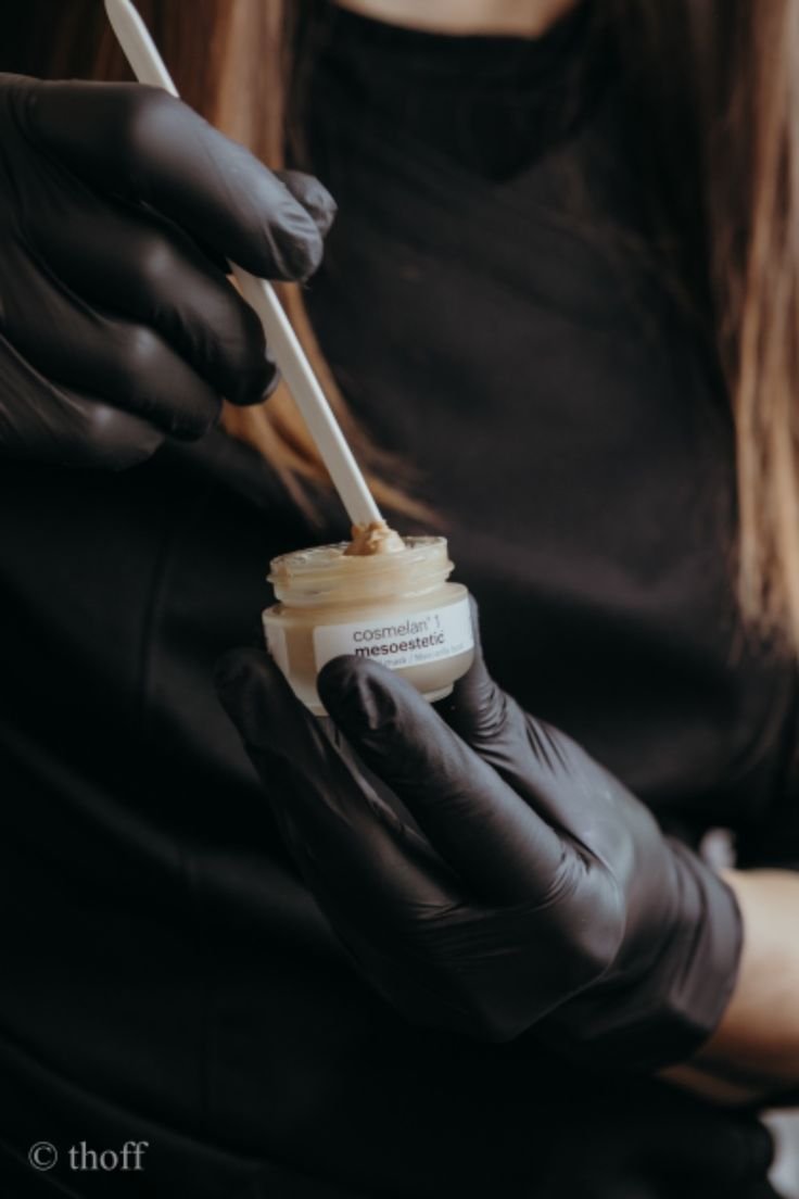 cosmelan® Behandlung Gesicht ll Hyperpigmentierung & Pigmentflecken